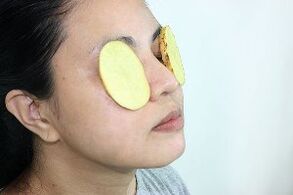 השימוש בתפוחי אדמה לצורך התחדשות סביב העיניים